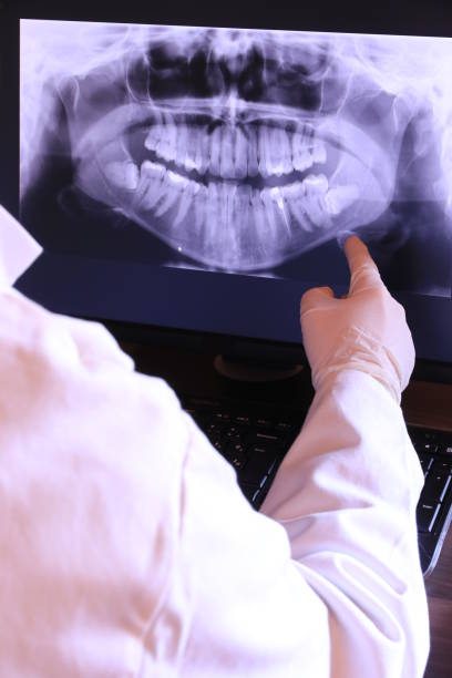 Best Emergency Tooth Extraction in Saunders Lake, OR