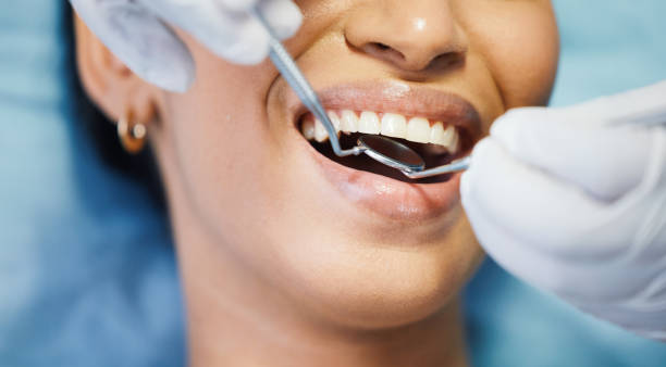 Best Emergency Denture Repair in Saunders Lake, OR